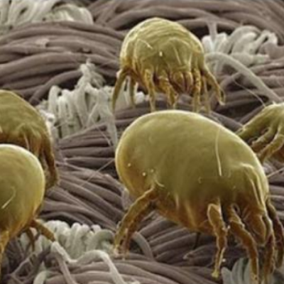 BỆNH LÝ DỊ ỨNG - CHUẨN ĐOÁN VÀ ĐIỀU TRỊ